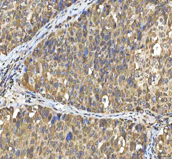 Anti-SMIM8 Antibody