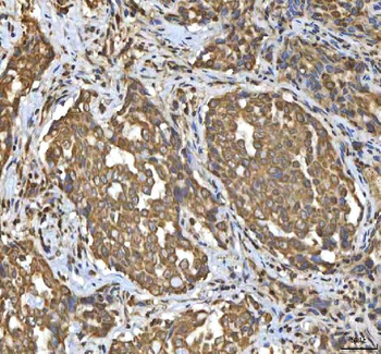 Anti-SMIM8 Antibody