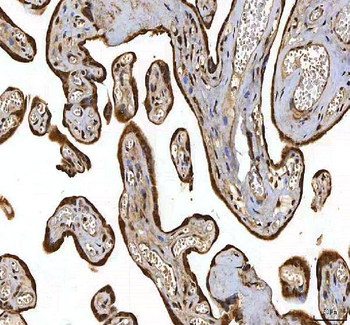 Anti-SMIM8 Antibody