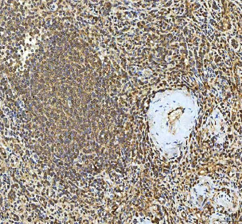 Anti-SMIM8 Antibody