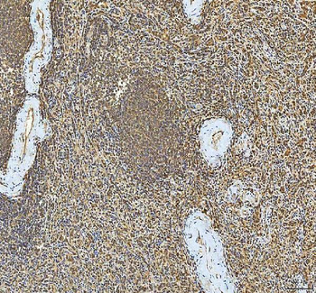 Anti-SMIM8 Antibody
