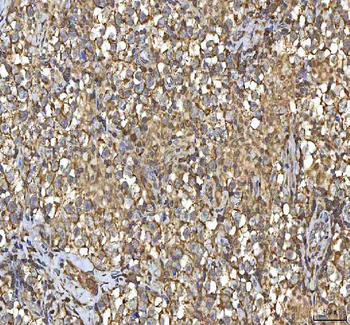 Anti-SMIM8 Antibody