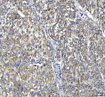 Anti-Huntingtin/HTT Antibody