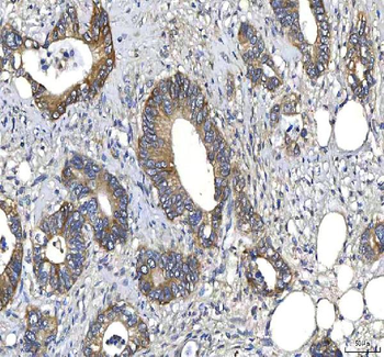 Anti-Huntingtin/HTT Antibody