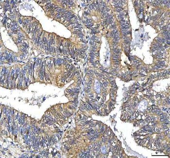 Anti-Huntingtin/HTT Antibody