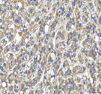 Anti-Huntingtin/HTT Antibody