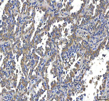 Anti-Huntingtin/HTT Antibody