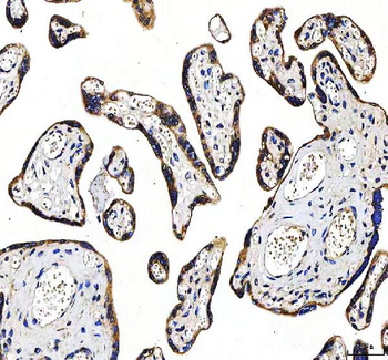 Anti-Huntingtin/HTT Antibody