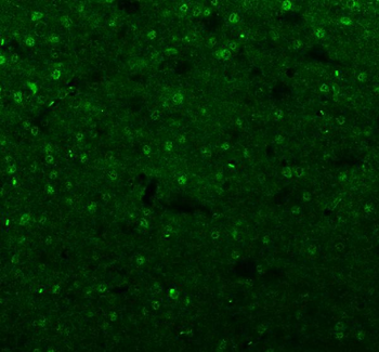 Anti-Islet 1/ISL1 Antibody