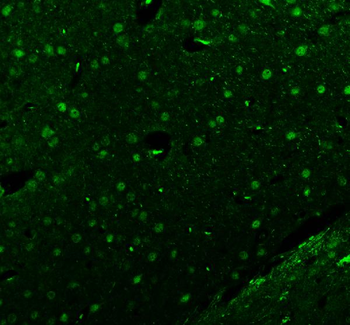 Anti-Islet 1/ISL1 Antibody