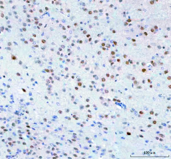 Anti-Islet 1/ISL1 Antibody