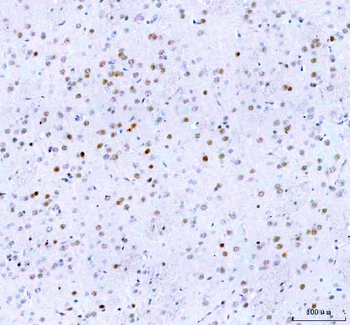 Anti-Islet 1/ISL1 Antibody