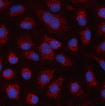 Anti-HSPA4L Antibody