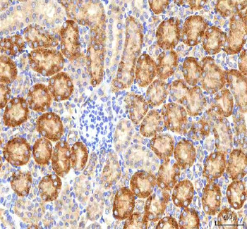 Anti-HSDL2 Antibody