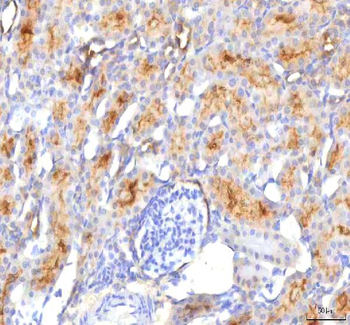 Anti-HSDL2 Antibody