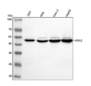 Anti-HSDL2 Antibody