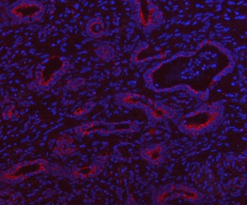 Anti-HSDL2 Antibody
