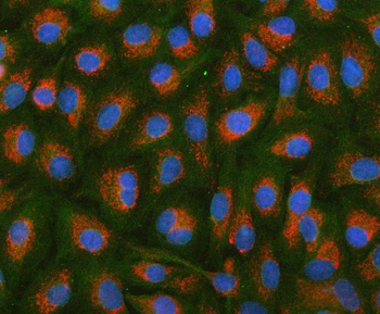 Anti-HSDL2 Antibody