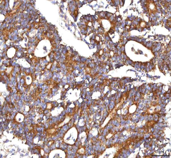 Anti-HSDL2 Antibody