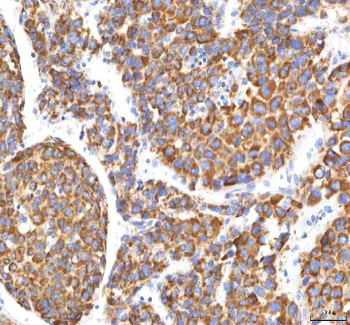 Anti-HSDL2 Antibody