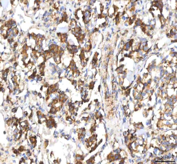 Anti-HSDL2 Antibody