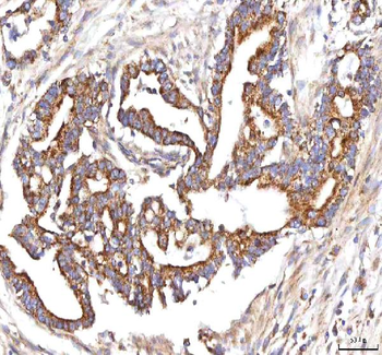 Anti-HSDL2 Antibody