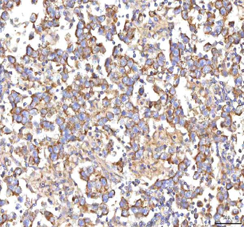 Anti-HSDL2 Antibody
