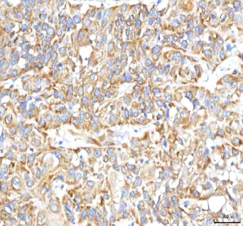 Anti-HSDL2 Antibody