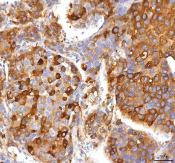 Anti-HSD17B13 Antibody