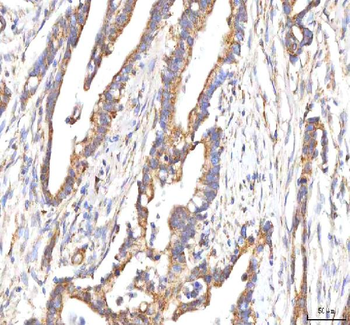 Anti-HSD17B13 Antibody