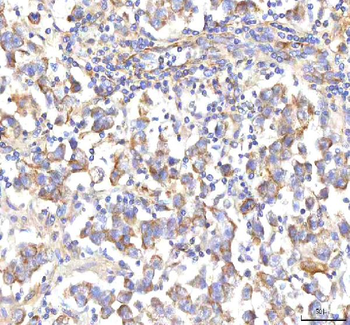 Anti-HSD17B13 Antibody