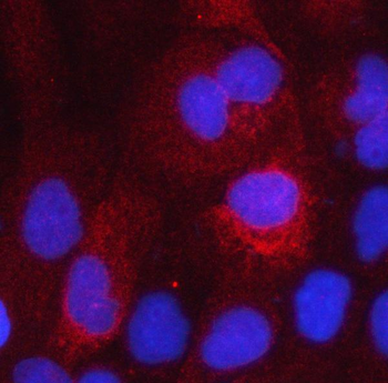 Anti-HSD17B2 Antibody