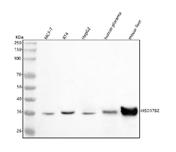 Anti-HSD17B2 Antibody