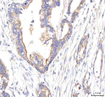 Anti-HEPACAM2 Antibody