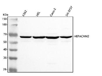 Anti-HEPACAM2 Antibody