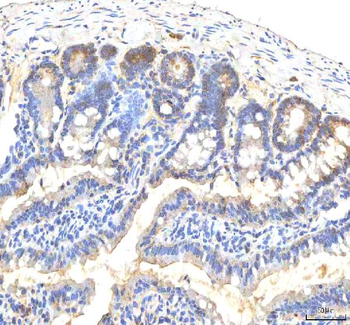 Anti-ITPA Antibody