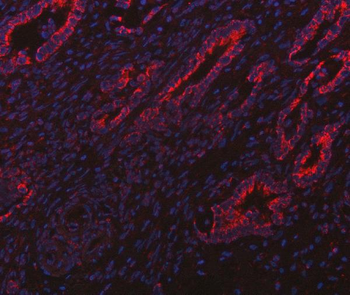 Anti-ITPA Antibody