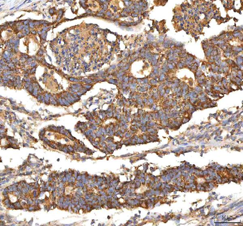 Anti-ITPA Antibody