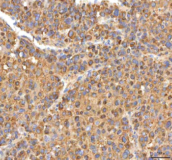 Anti-ITPA Antibody