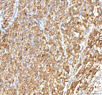 Anti-ITPA Antibody