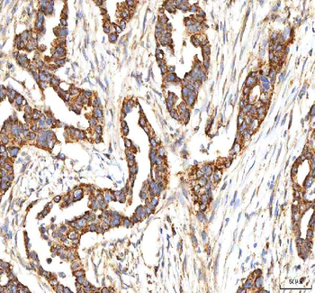Anti-ITPA Antibody