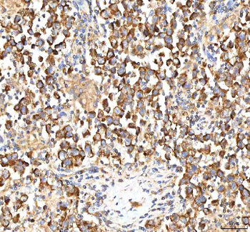 Anti-ITPA Antibody