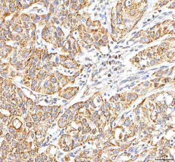 Anti-ITPA Antibody