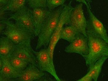 Centromere protein R/ITGB3BP Antibody