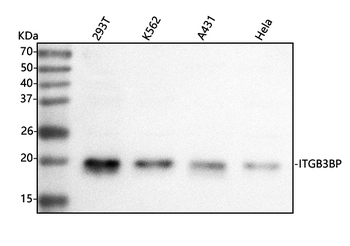 Anti-Centromere protein R/ITGB3BP Antibody