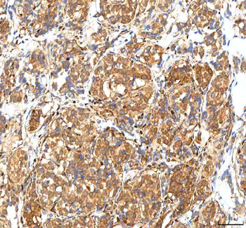 Anti-ISYNA1 Antibody