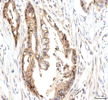 Anti-ISYNA1 Antibody