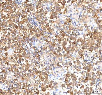 Anti-ISYNA1 Antibody