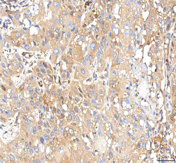 Anti-ISYNA1 Antibody