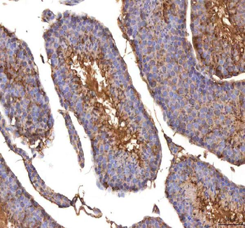 Anti-ISYNA1 Antibody